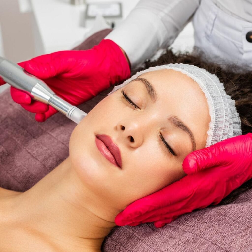 microneedling